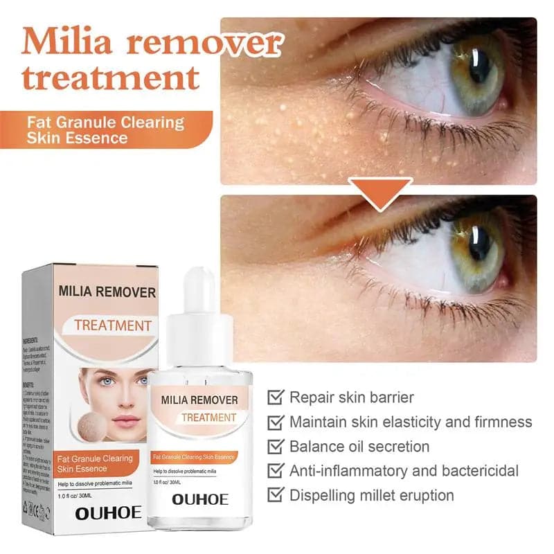 Fat Granules Removal Eye Serum Anti Dark Circle Eye Bags Fade Fine Line Essence Anti-Puffiness Moisturizing Skin Care Products - Boutique Beauté Santé 