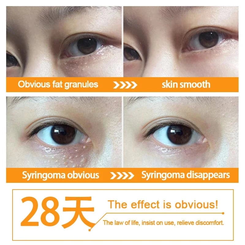 Fat Granules Removal Eye Serum Anti Dark Circle Eye Bags Fade Fine Line Essence Anti-Puffiness Moisturizing Skin Care Products - Boutique Beauté Santé 