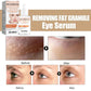 Fat Granules Removal Eye Serum Anti Dark Circle Eye Bags Fade Fine Line Essence Anti-Puffiness Moisturizing Skin Care Products - Boutique Beauté Santé 