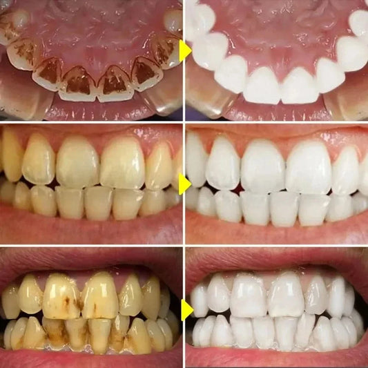 Bandes de dentifrice 5D pour le blanchiment des dents V34, livres d'hygiène buccale, outils de blanchiment dentaire Wiltshire, haleine fraîche, soins dentaires