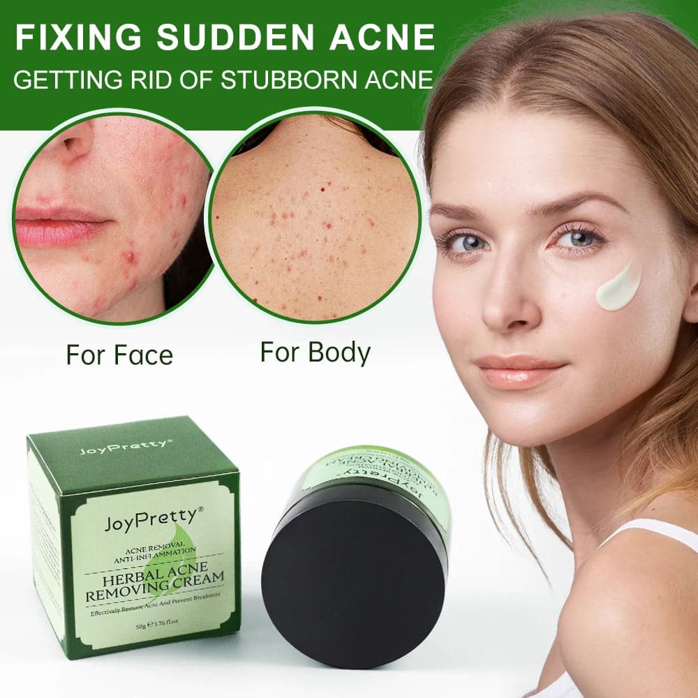 Herbal Acne Treatment Face Cream Pimple Scar Removal Oil control Against Acne Marks Facial Moisturizing Cream Skin Care Beauty - Boutique Beauté Santé 