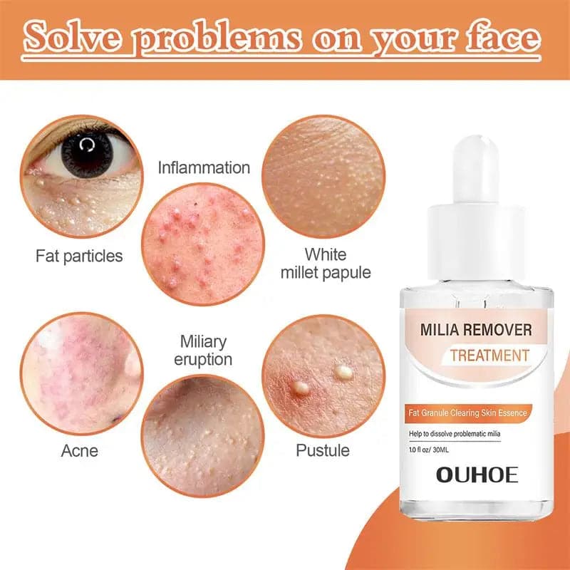 Fat Granules Removal Eye Serum Anti Dark Circle Eye Bags Fade Fine Line Essence Anti-Puffiness Moisturizing Skin Care Products - Boutique Beauté Santé 