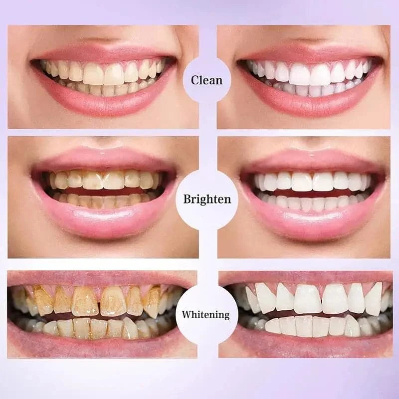 Bandes de dentifrice 5D pour le blanchiment des dents V34, livres d'hygiène buccale, outils de blanchiment dentaire Wiltshire, haleine fraîche, soins dentaires